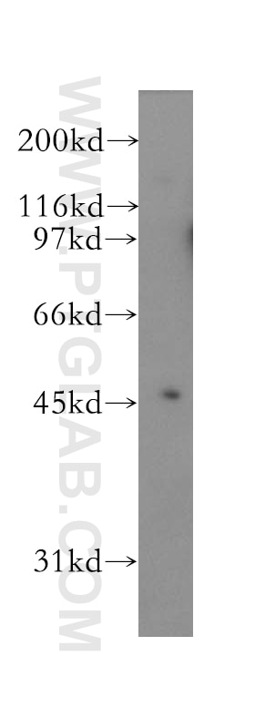 Western Blot (WB) analysis of human brain tissue using Kir4.1 Polyclonal antibody (12503-1-AP)