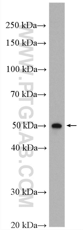 Western Blot (WB) analysis of rat skeletal muscle tissue using Kir6.2 Polyclonal antibody (16920-1-AP)