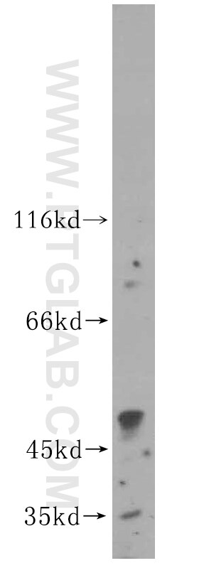 Western Blot (WB) analysis of HepG2 cells using Kir6.2 Polyclonal antibody (16920-1-AP)