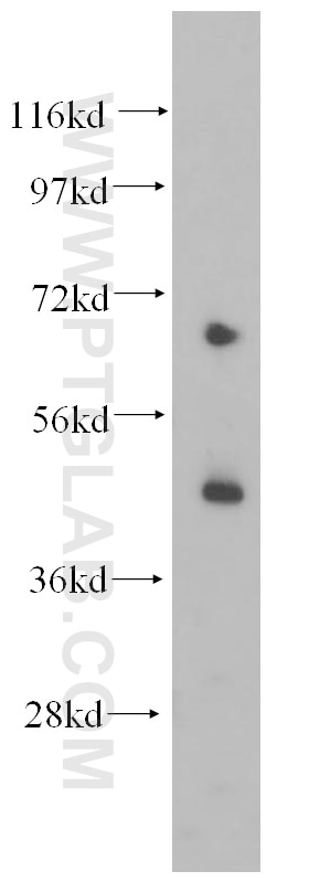 Western Blot (WB) analysis of human heart tissue using Kir6.2 Polyclonal antibody (16920-1-AP)