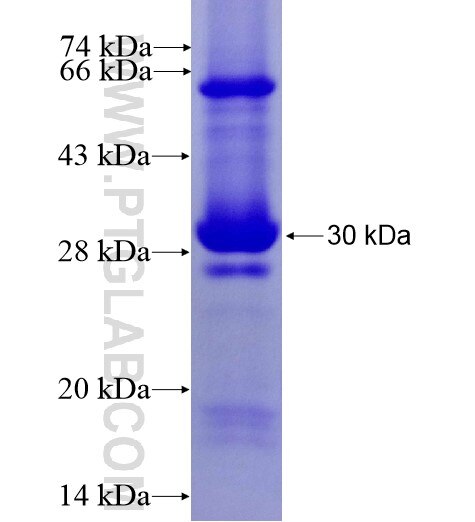 Kir6.2 fusion protein Ag10368 SDS-PAGE