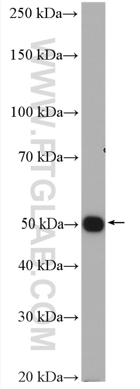 Western Blot (WB) analysis of rat lung tissue using Kir2.2 Polyclonal antibody (14135-1-AP)