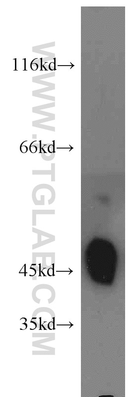 Western Blot (WB) analysis of mouse lung tissue using Kir2.2 Polyclonal antibody (14135-1-AP)