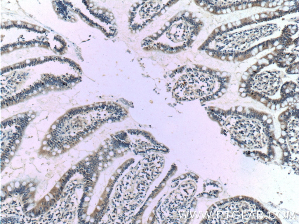 Immunohistochemistry (IHC) staining of human small intestine tissue using Kir7.1 Polyclonal antibody (12657-1-AP)