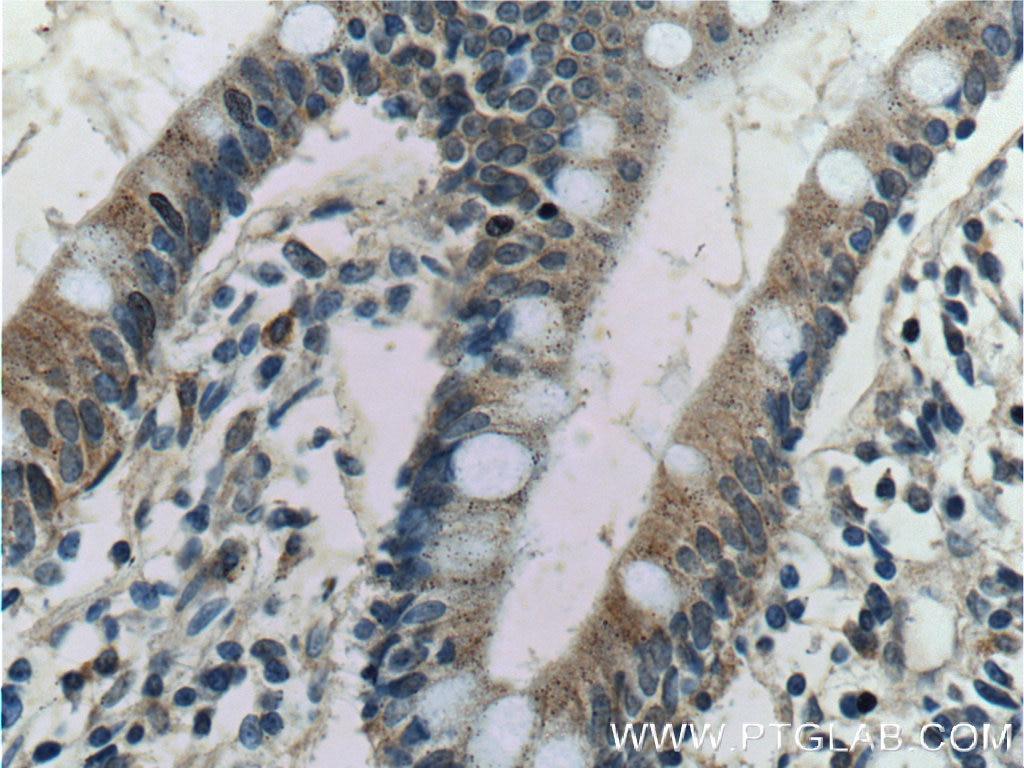 Immunohistochemistry (IHC) staining of human small intestine tissue using Kir7.1 Polyclonal antibody (12657-1-AP)