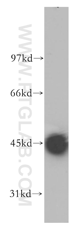 Western Blot (WB) analysis of human kidney tissue using Kir7.1 Polyclonal antibody (12657-1-AP)