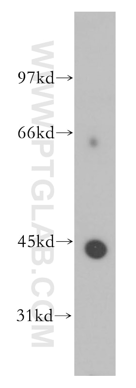 Western Blot (WB) analysis of human brain tissue using Kir7.1 Polyclonal antibody (12657-1-AP)