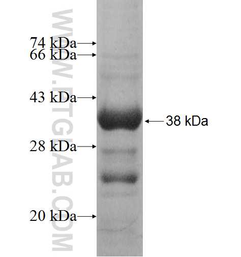 KCNJ14 fusion protein Ag5666 SDS-PAGE KCNJ14 fusion protein Ag5666 SDS-PAGE