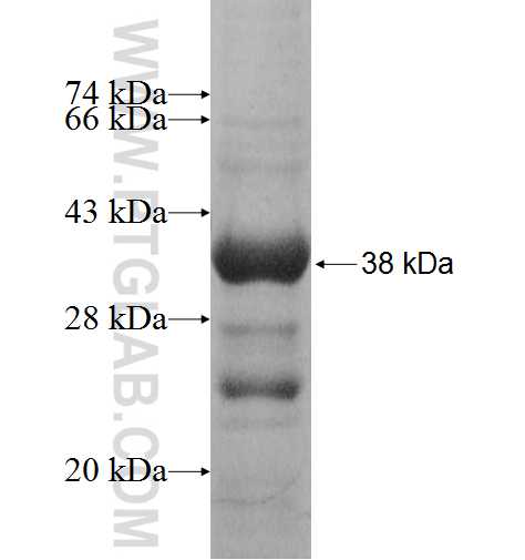 KCNJ14 fusion protein Ag5666 SDS-PAGE