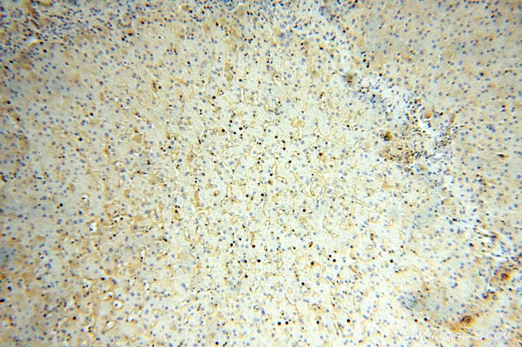 Immunohistochemistry (IHC) staining of human liver tissue using KCNJ15 Polyclonal antibody (15988-1-AP)