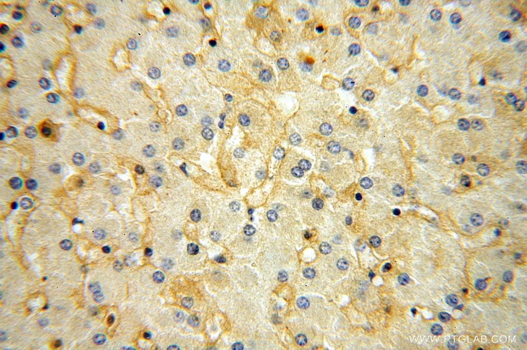 Immunohistochemistry (IHC) staining of human liver tissue using KCNJ15 Polyclonal antibody (15988-1-AP)