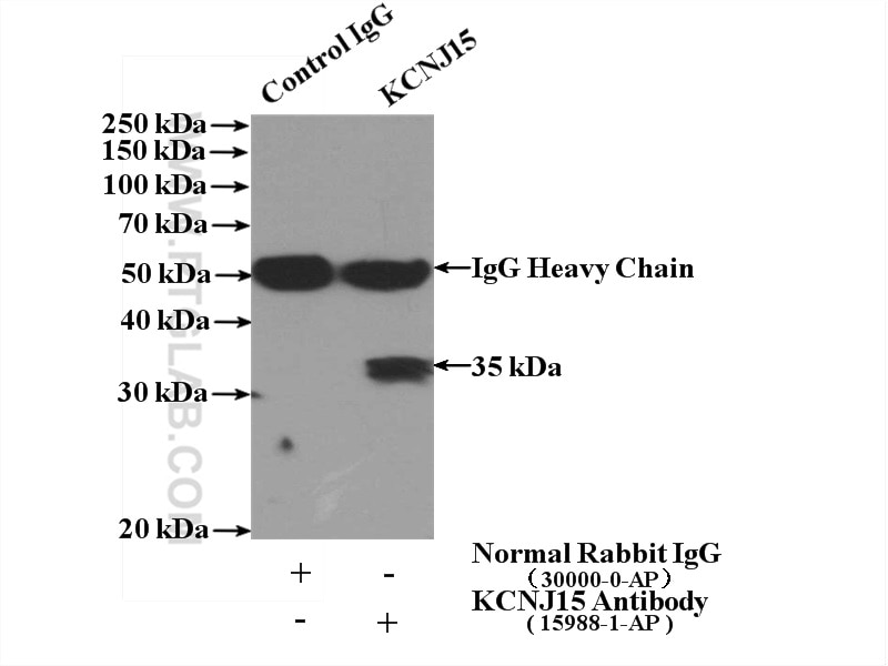 Immunoprecipitation (IP) experiment of HepG2 cells using KCNJ15 Polyclonal antibody (15988-1-AP)