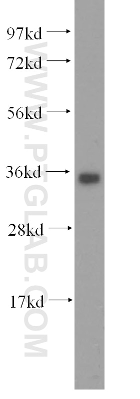 WB analysis of HepG2 using 15988-1-AP