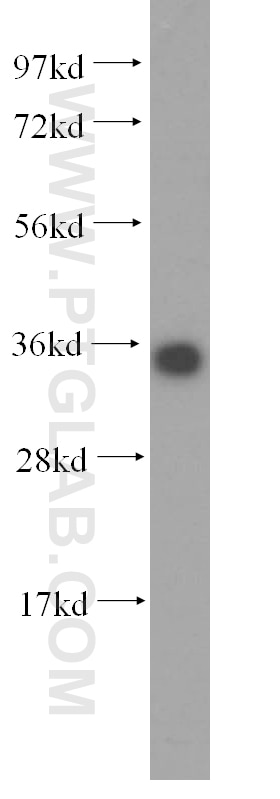 Western Blot (WB) analysis of HeLa cells using KCNJ15 Polyclonal antibody (15988-1-AP)
