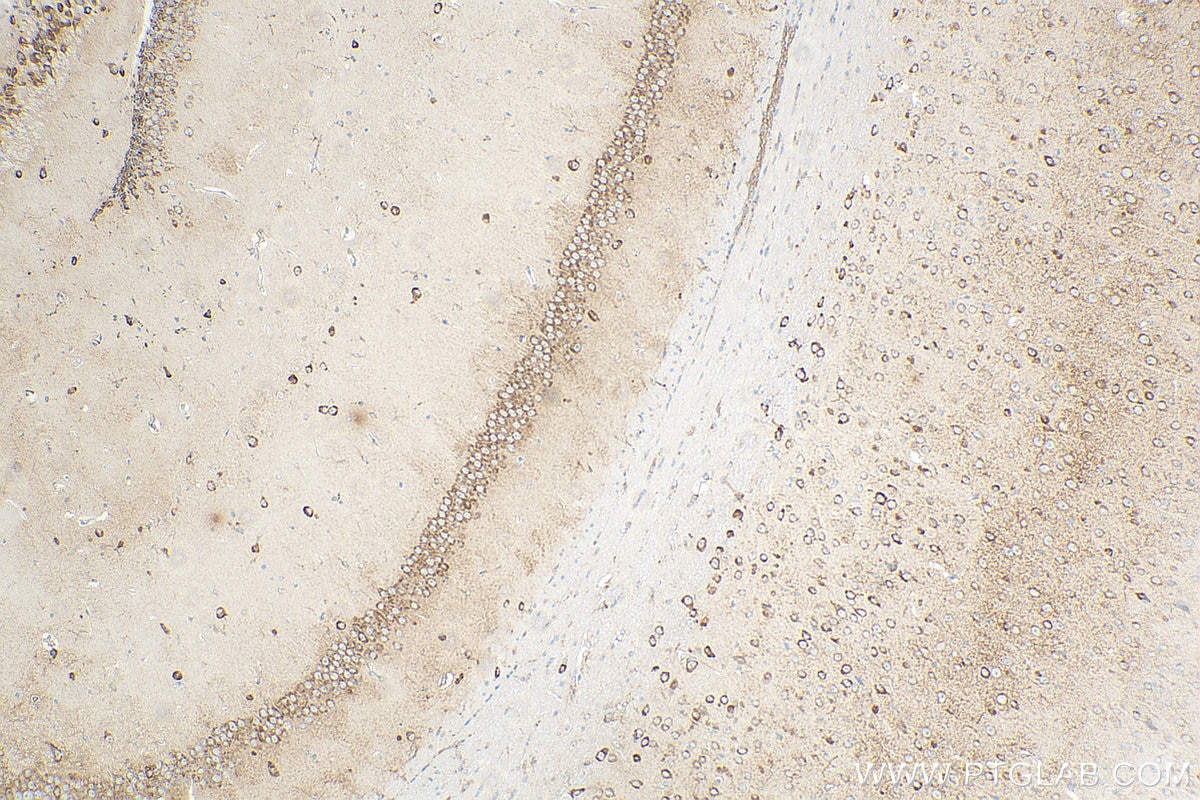 Immunohistochemistry (IHC) staining of mouse brain tissue using KCNJ15 Recombinant antibody (83257-5-RR)