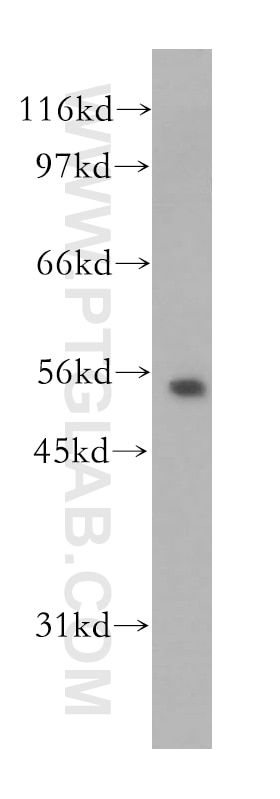 Western Blot (WB) analysis of human brain tissue using Kir5.1 Polyclonal antibody (12696-1-AP)