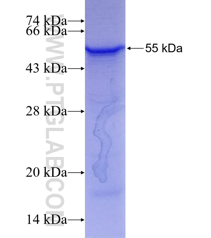 KCNJ16 fusion protein Ag3405 SDS-PAGE