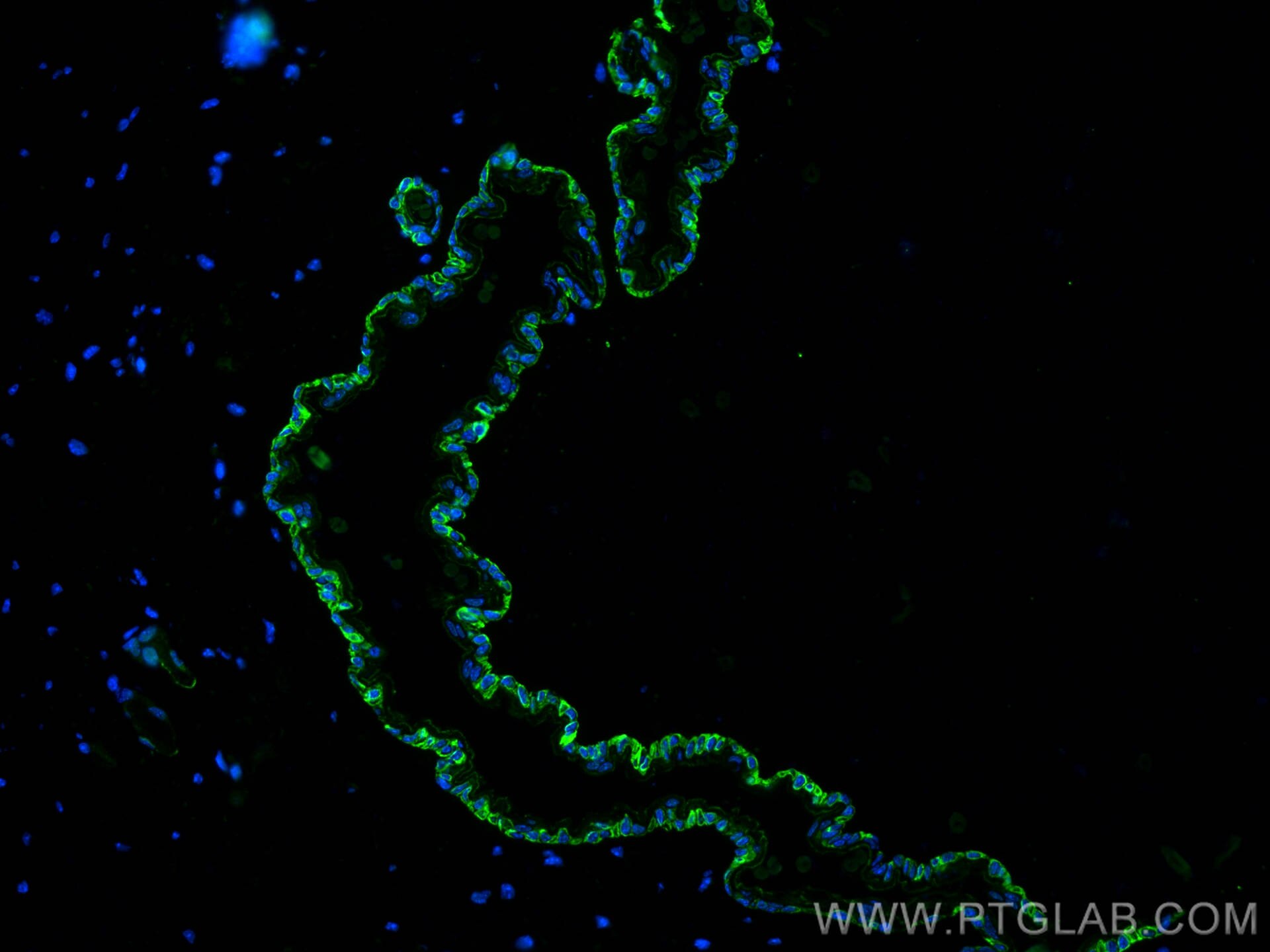 Immunofluorescence (IF) / fluorescent staining of mouse skin tissue using KCNJ18 Polyclonal antibody (30911-1-AP)