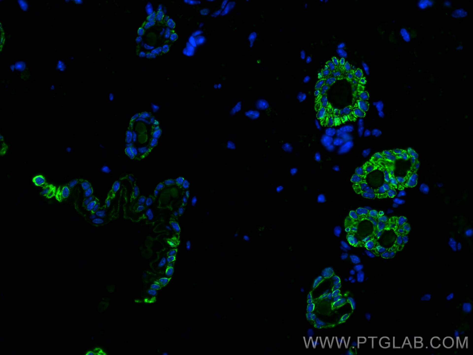 Immunofluorescence (IF) / fluorescent staining of mouse skin tissue using KCNJ18 Polyclonal antibody (30911-1-AP)