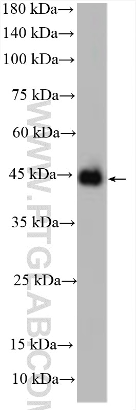 Western Blot (WB) analysis of mouse skin tissue using KCNJ18 Polyclonal antibody (30911-1-AP)