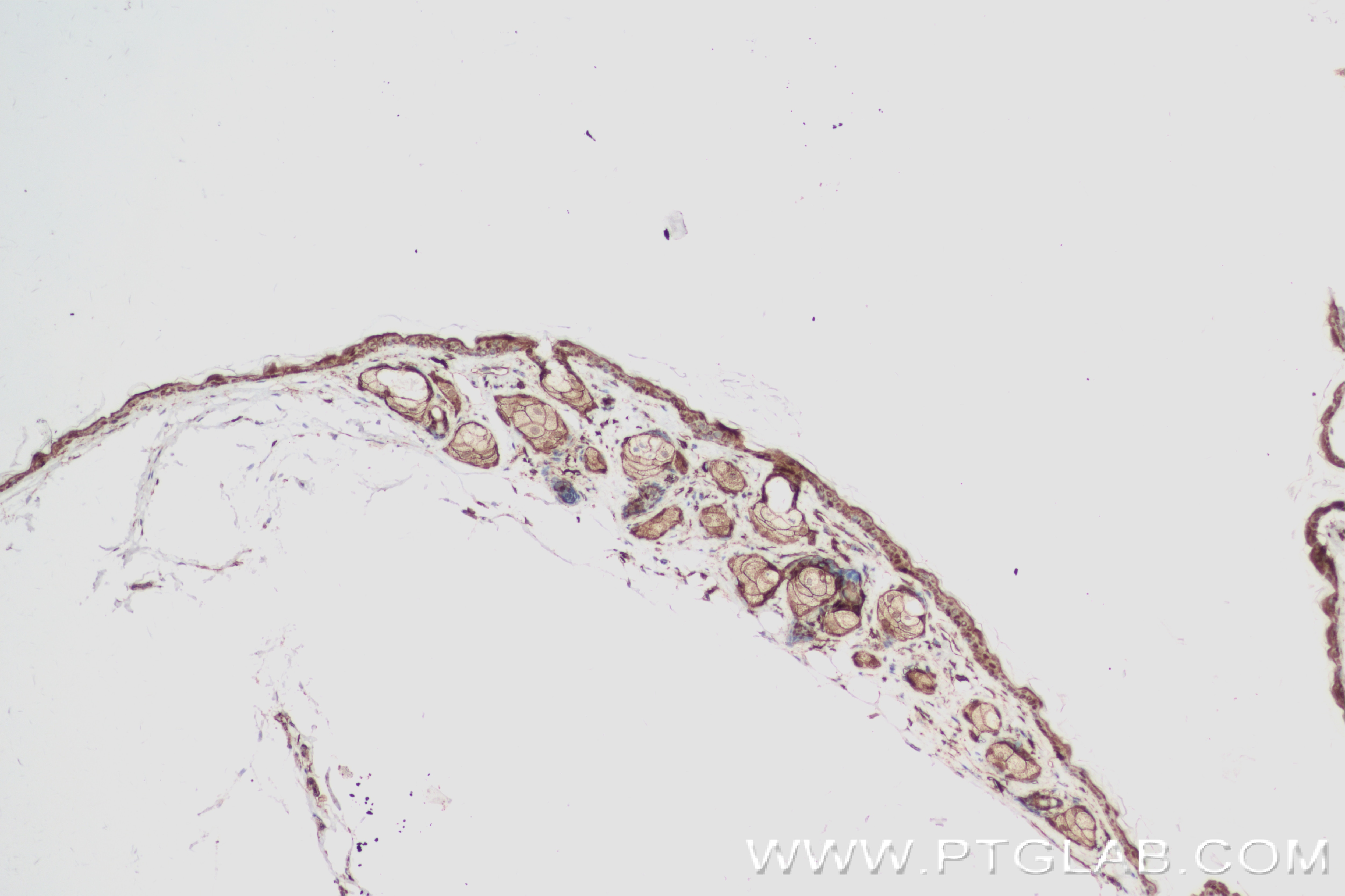 Immunohistochemistry (IHC) staining of mouse skin tissue using KCNJ18 Recombinant antibody (84203-5-RR)