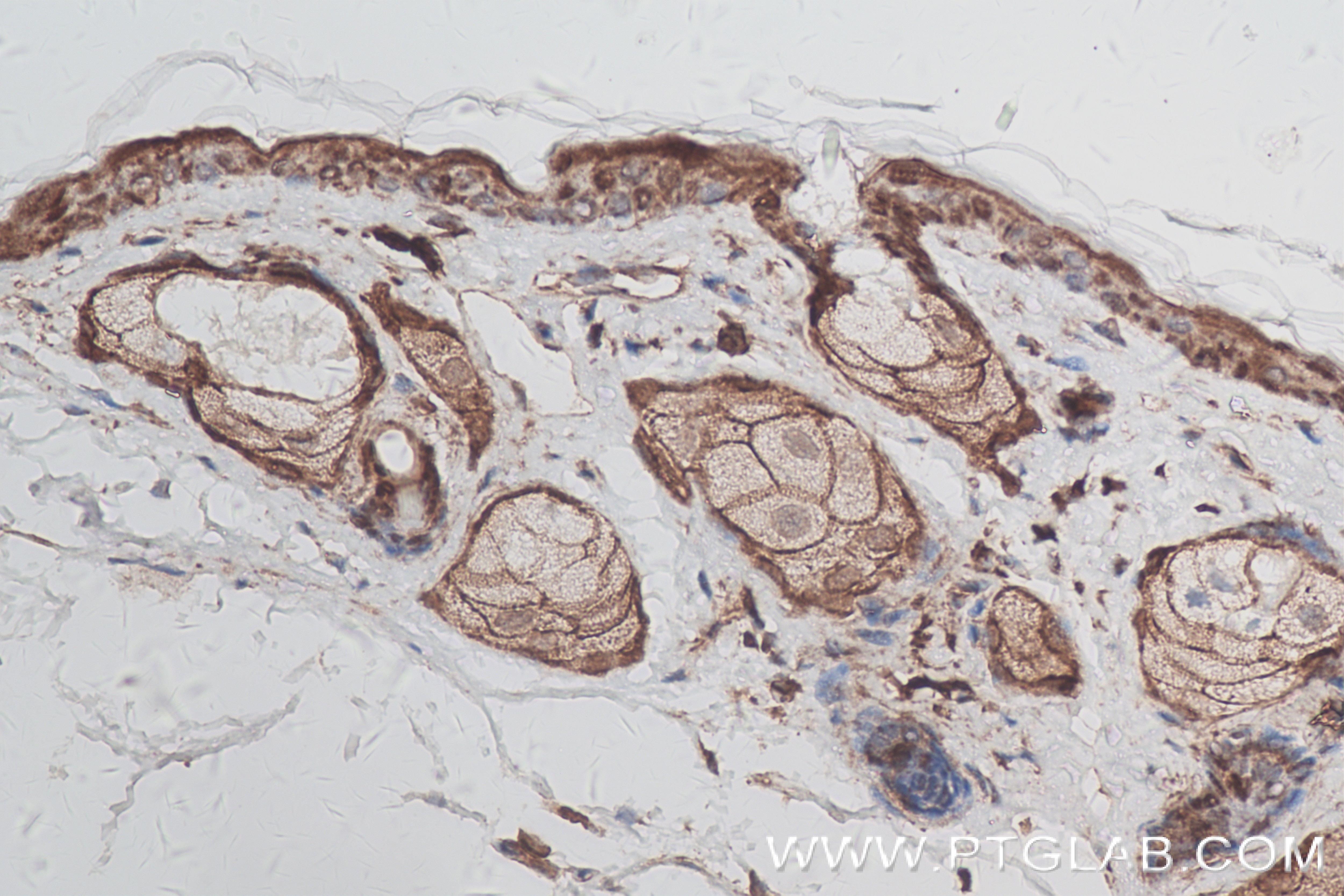 Immunohistochemistry (IHC) staining of mouse skin tissue using KCNJ18 Recombinant antibody (84203-5-RR)