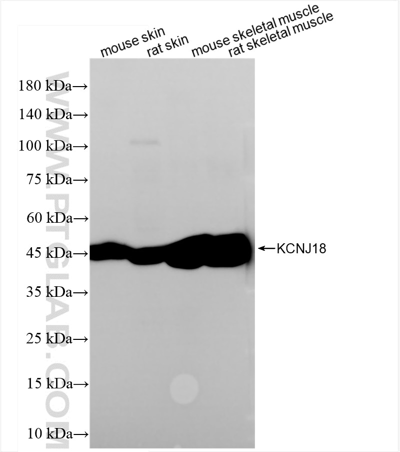 Western Blot (WB) analysis of various lysates using KCNJ18 Recombinant antibody (84203-5-RR)