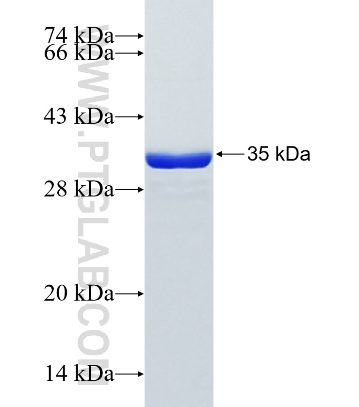 KCNJ18 fusion protein Ag34177 SDS-PAGE KCNJ18 fusion protein Ag34177 SDS-PAGE