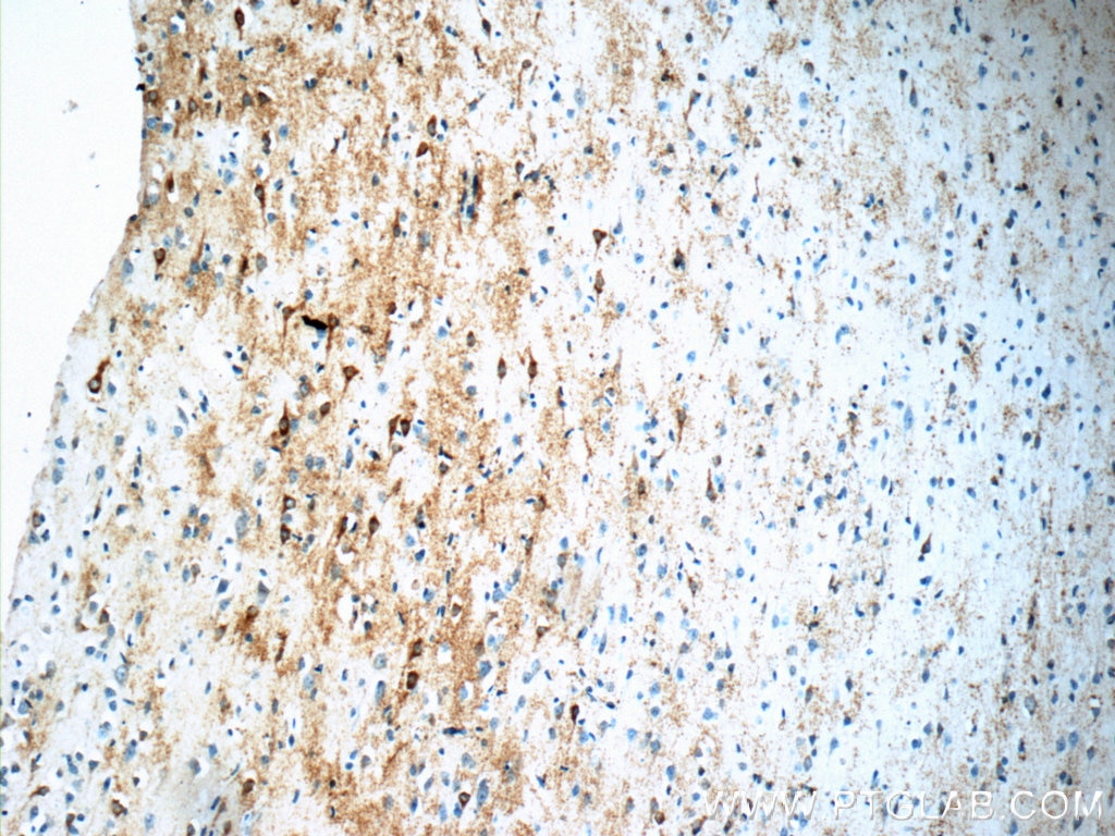 IHC staining of human brain using 19965-1-AP