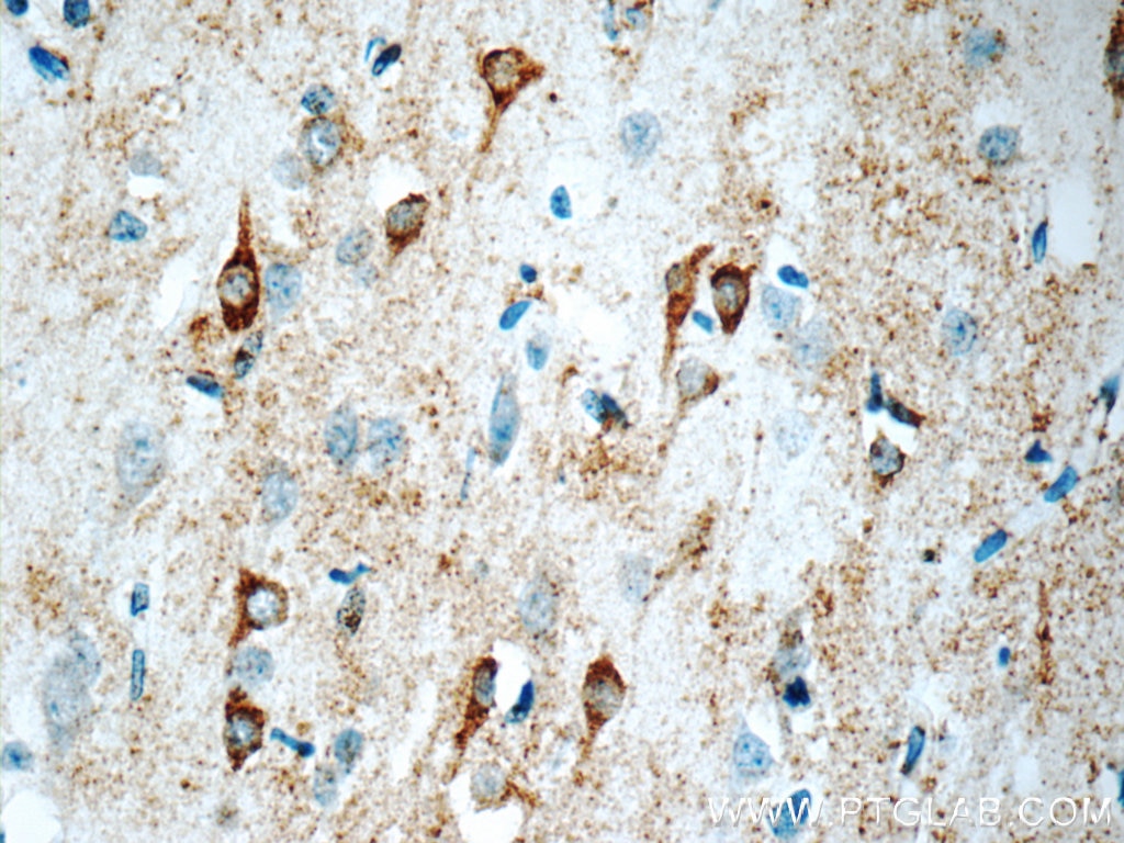 IHC staining of human brain using 19965-1-AP