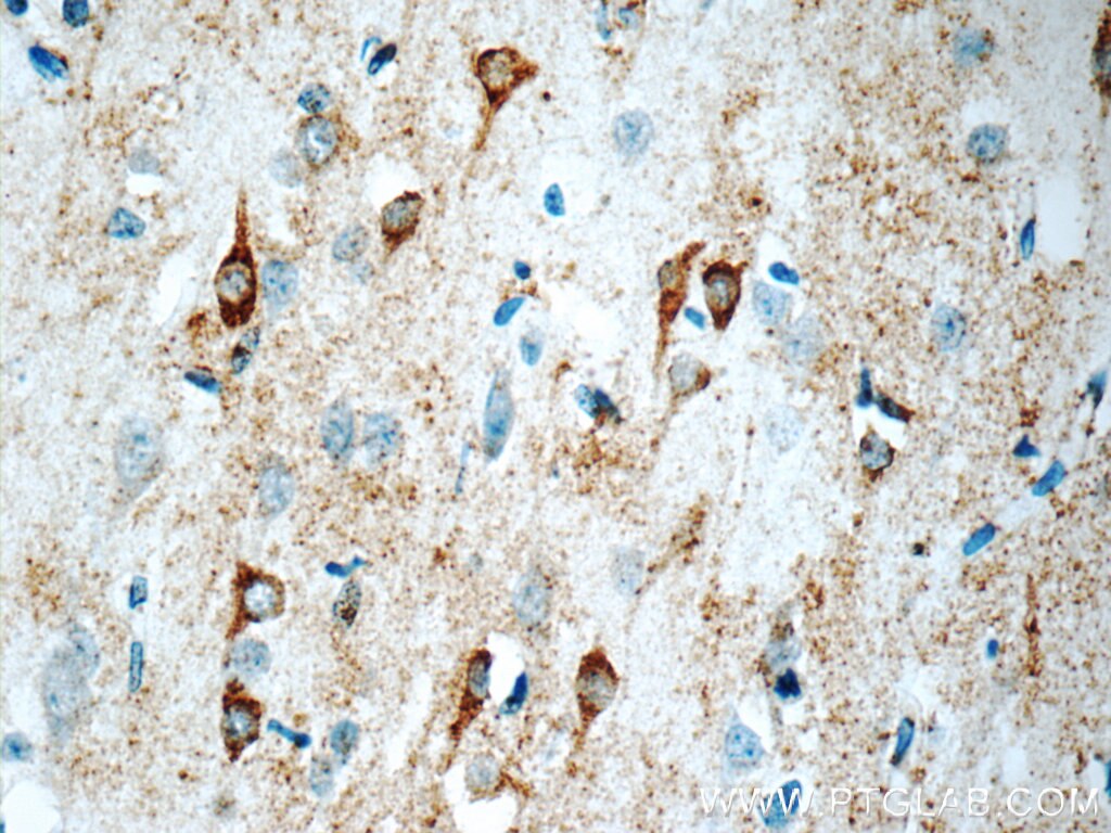 Kir2.1 Polyclonal antibody