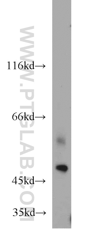 Western Blot (WB) analysis of A549 cells using Kir2.1 Polyclonal antibody (19965-1-AP)