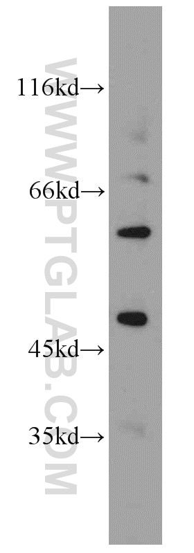 Western Blot (WB) analysis of A549 cells using Kir2.1 Polyclonal antibody (19965-1-AP)