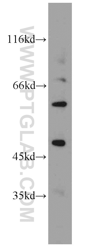 WB analysis of A549 using 19965-1-AP