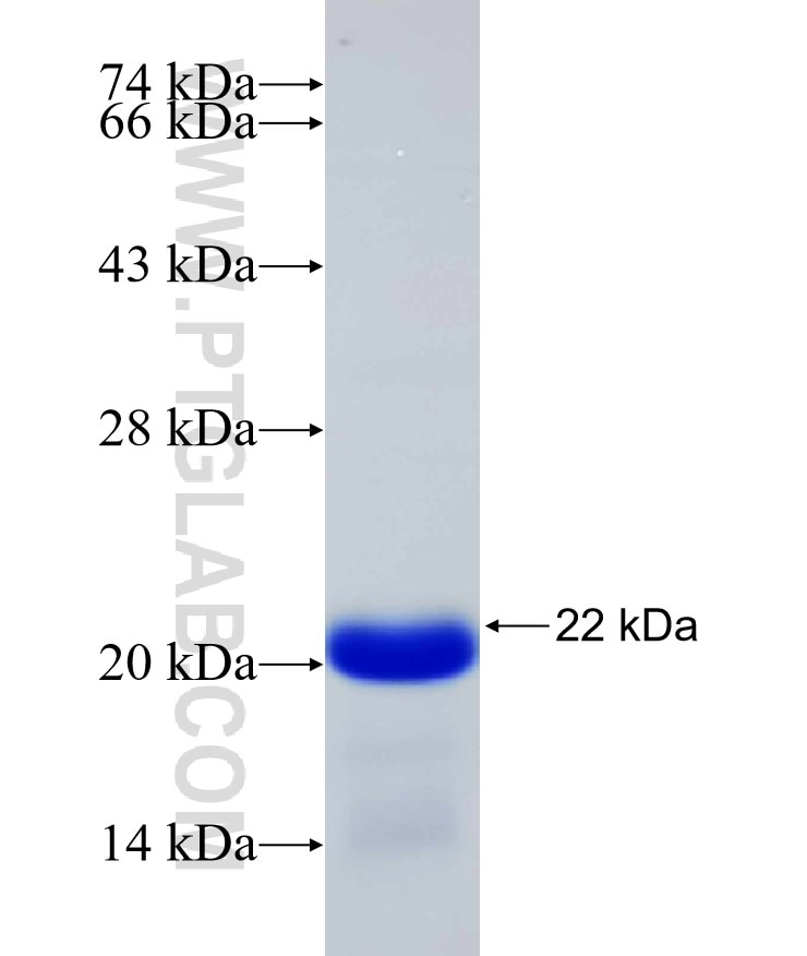KCNJ2 fusion protein Ag30715 SDS-PAGE KCNJ2 fusion protein Ag30715 SDS-PAGE