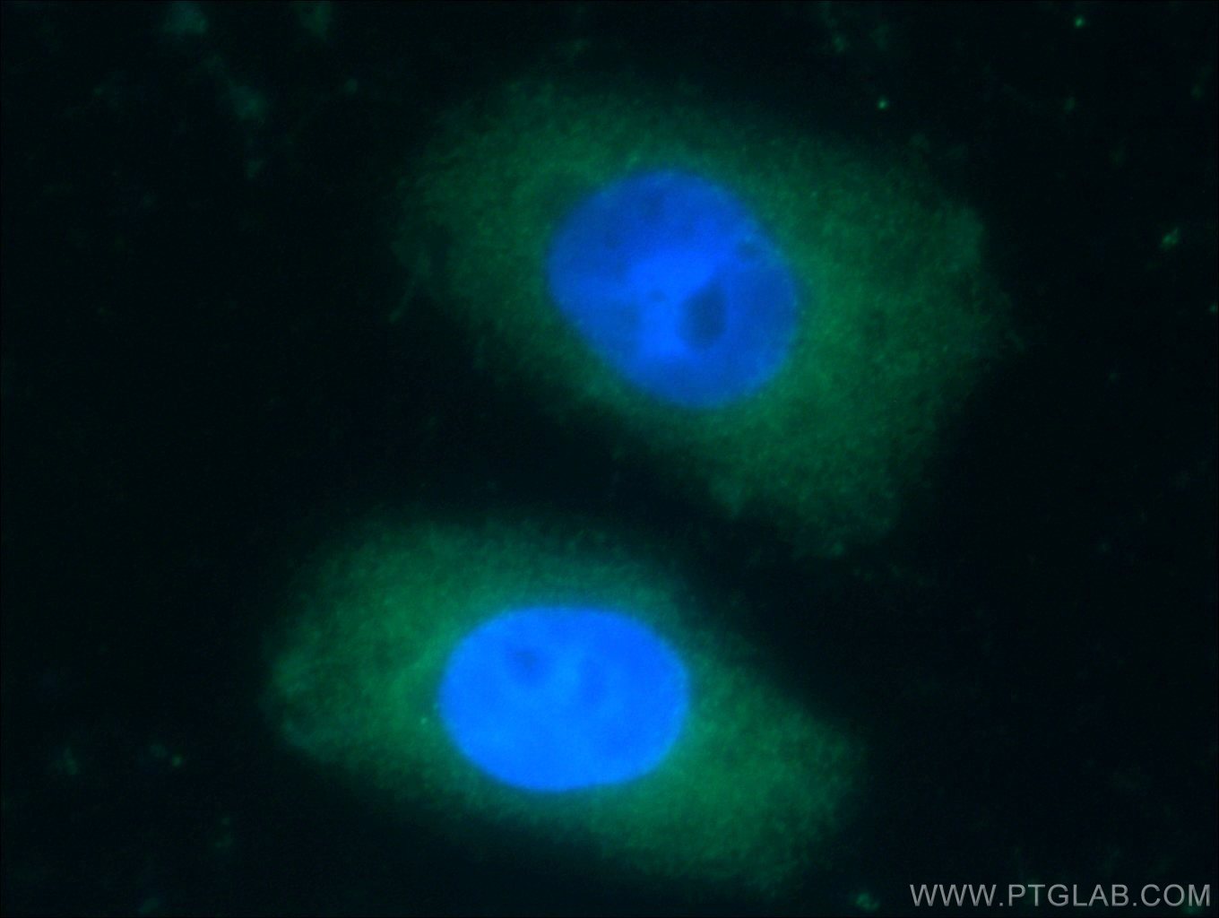 Immunofluorescence (IF) / fluorescent staining of HeLa cells using KCNJ3 Polyclonal antibody (16985-1-AP)