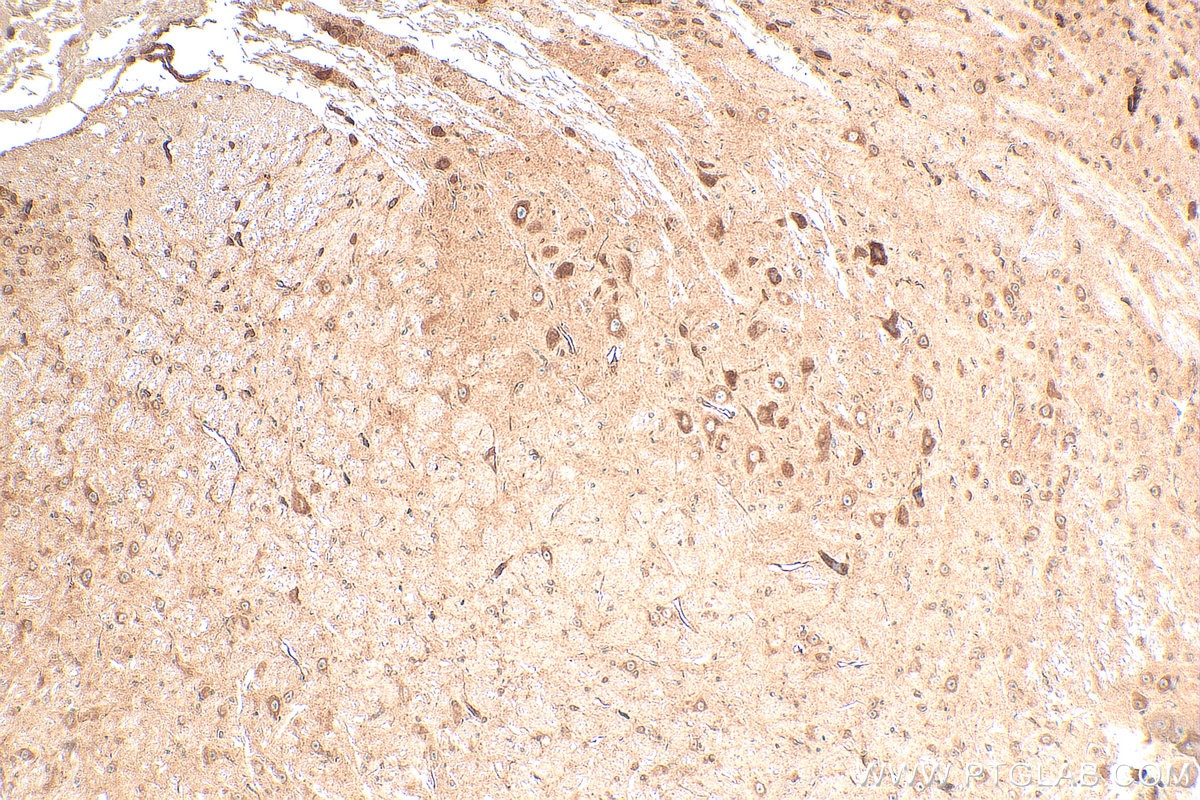 Immunohistochemistry (IHC) staining of mouse cerebellum tissue using KCNJ3 Polyclonal antibody (16985-1-AP)