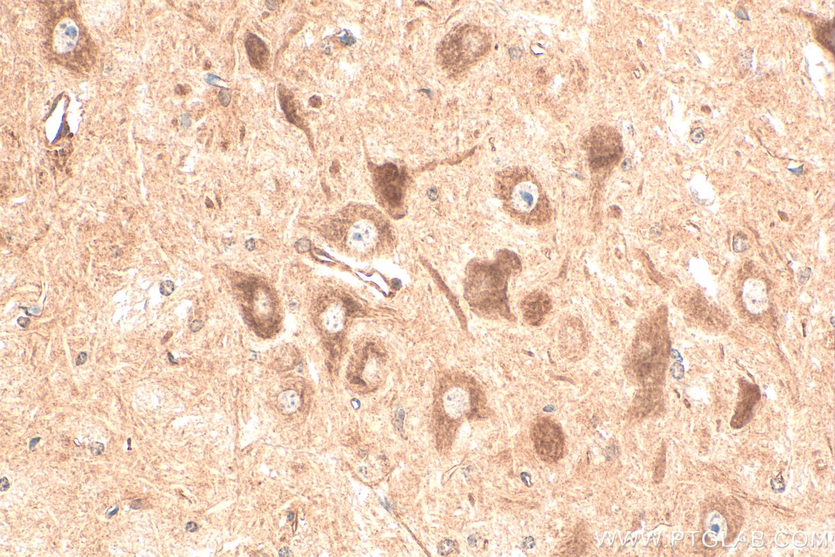 Immunohistochemistry (IHC) staining of mouse cerebellum tissue using KCNJ3 Polyclonal antibody (16985-1-AP)