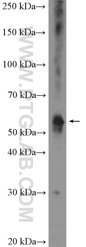 Western Blot (WB) analysis of mouse brain tissue using KCNJ3 Polyclonal antibody (16985-1-AP)