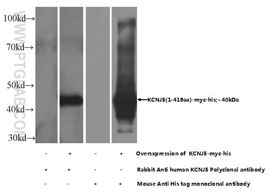 KCNJ5 Polyclonal antibody
