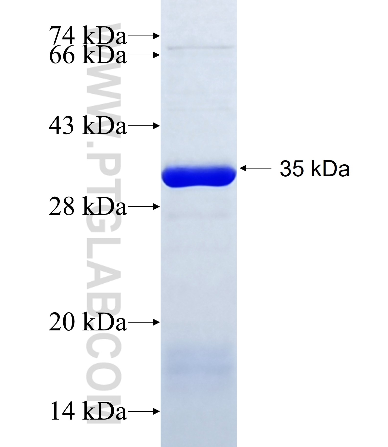 KCNJ5 fusion protein Ag34838 SDS-PAGE KCNJ5 fusion protein Ag34838 SDS-PAGE