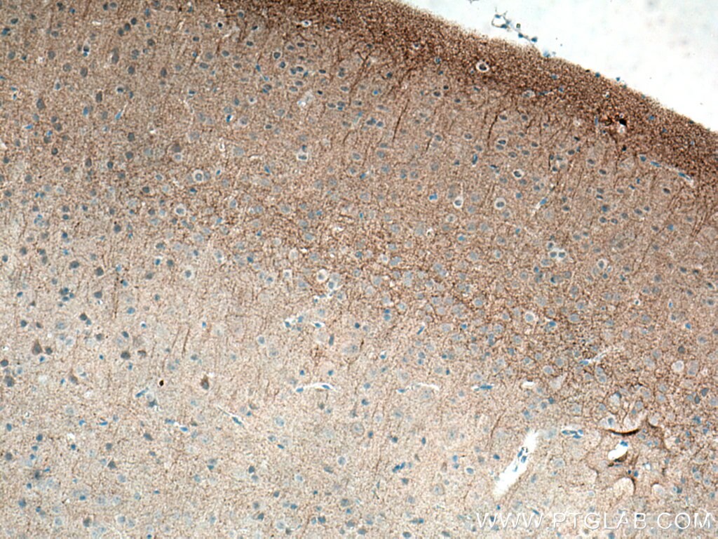 Immunohistochemistry (IHC) staining of mouse brain tissue using GIRK2 Polyclonal antibody (21647-1-AP)