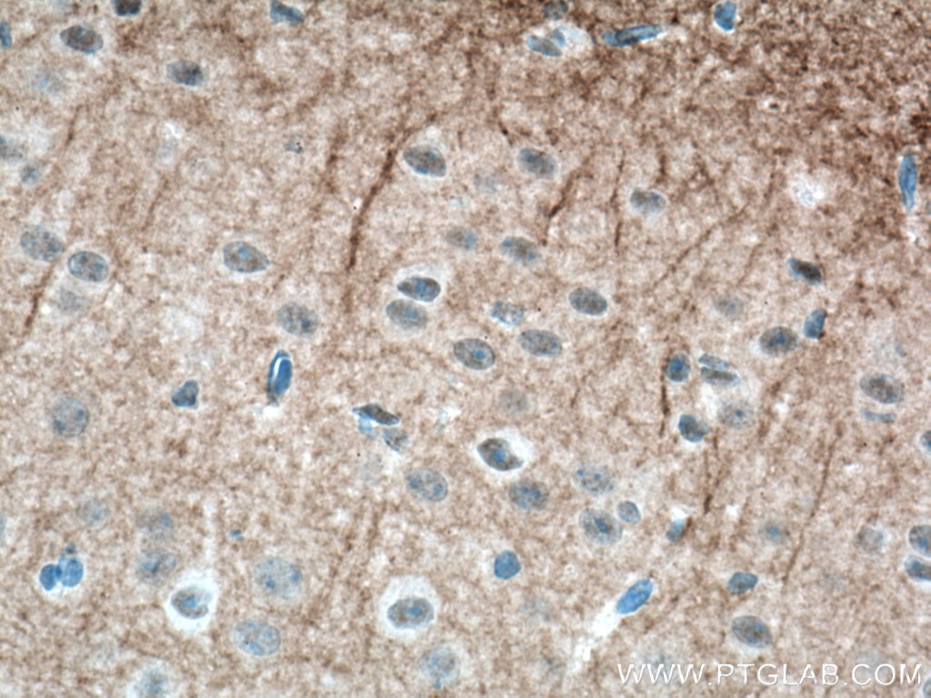 Immunohistochemistry (IHC) staining of mouse brain tissue using GIRK2 Polyclonal antibody (21647-1-AP)