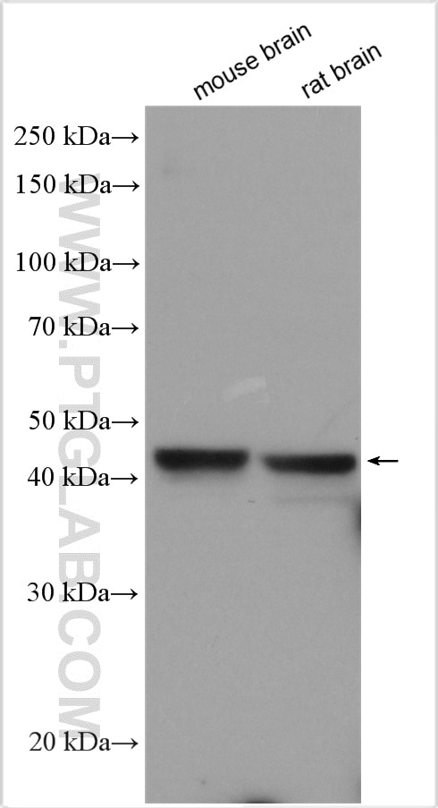 Western Blot (WB) analysis of various lysates using GIRK2 Polyclonal antibody (21647-1-AP)