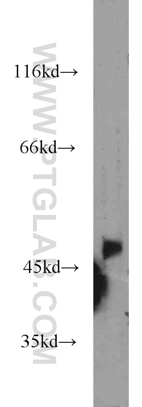 Western Blot (WB) analysis of mouse brain tissue using GIRK2 Polyclonal antibody (21647-1-AP)