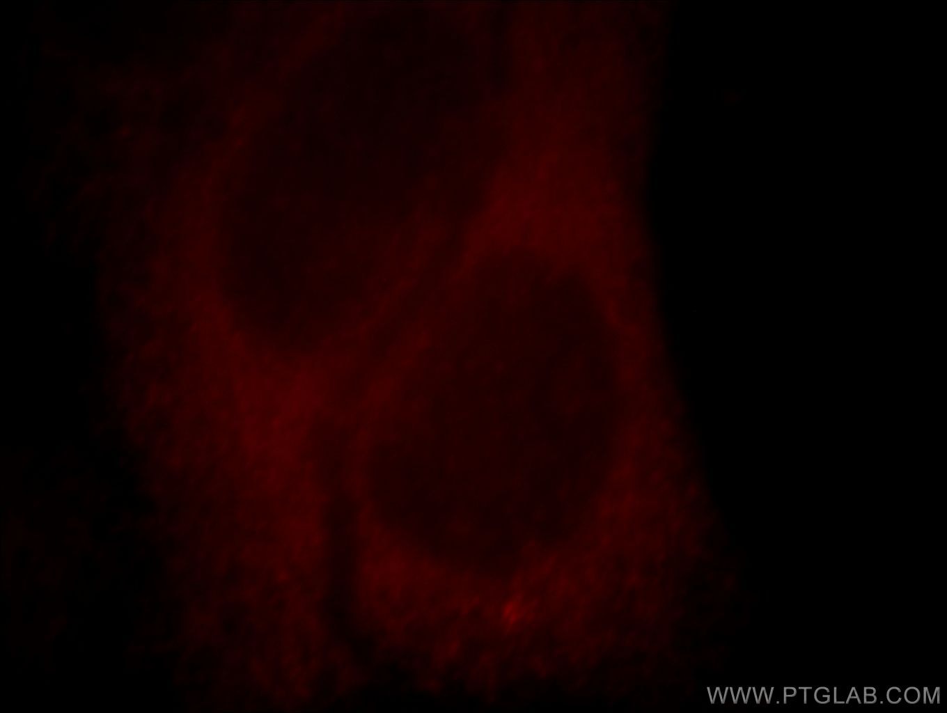 Immunofluorescence (IF) / fluorescent staining of HepG2 cells using Kir6.1 Polyclonal antibody (14954-1-AP)