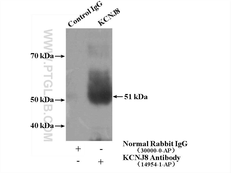 Immunoprecipitation (IP) experiment of mouse spleen tissue using Kir6.1 Polyclonal antibody (14954-1-AP)