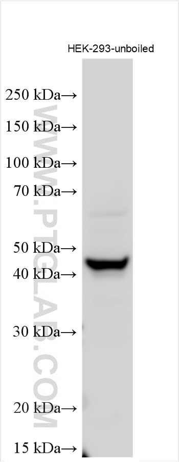 Western Blot (WB) analysis of various lysates using Kir6.1 Polyclonal antibody (14954-1-AP)