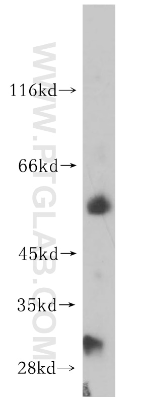 Western Blot (WB) analysis of mouse spleen tissue using Kir6.1 Polyclonal antibody (14954-1-AP)