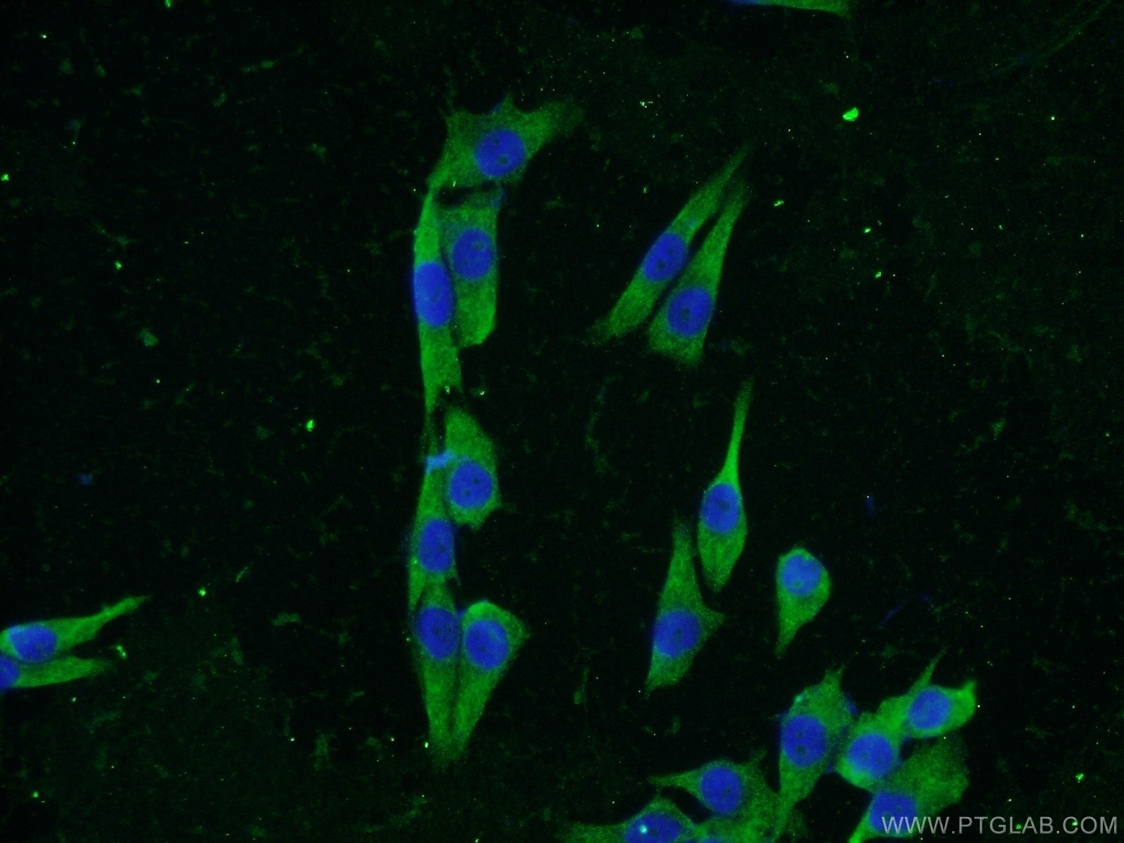 Immunofluorescence (IF) / fluorescent staining of A375 cells using KCNK18 Polyclonal antibody (23712-1-AP)